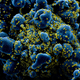 Imagen para el artículo titulado Este es el aspecto del coronavirus atacando una célula humana bajo el microscopio electrónico